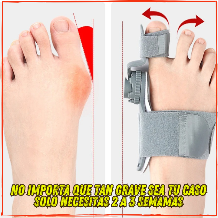 ✅Ya no mas Juanetes y Desvios en tus Pies👌Corrigelos en 2 a 3 Semanas(💥Pagas al Recibir+Envio Gratis) Ortopedico.