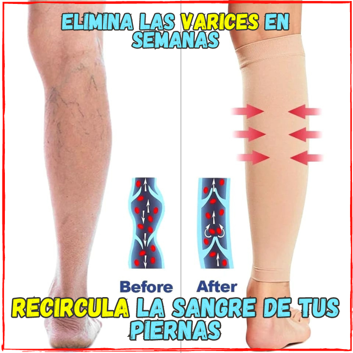 ✅Adios a la Hinchazon, Varices y Cansancio Muscular🙌, Pantorrillas de Compresion(💥Pagas al Recibirlo💥) Las Mas Comodas del Mercado.