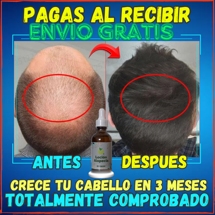 ✅Has que tu Pelo Vuelva a Crecer en 3 Meses😱, Locion Para Alopecia Para Hombre y Mujer(💥Pagas al Recibirlo💥)