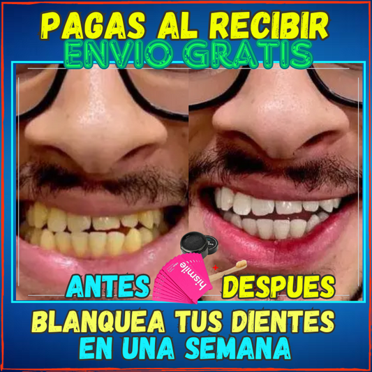 ✅Blanquea tus Dientes en una Semana😱, Pack 14 Tiras Blanqueadoras + Polvo Negro(💥Pagas al Recibirlo💥) Incluye Cepillo de Bambu