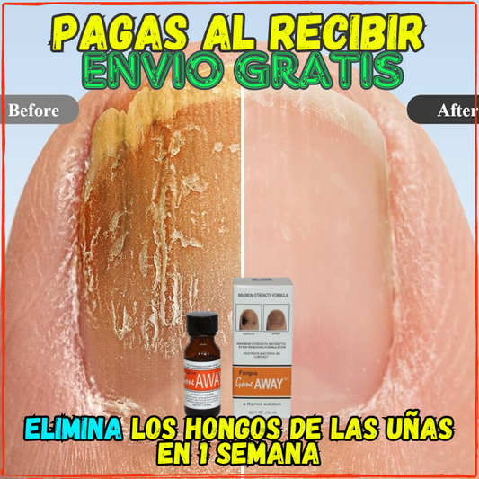 ✅Elimina los Hongos y Uñas Rotas en Semanas😱,Ten unas Uñas Impecables y Libres de Hongos(💥Pagas al Recibirlo💥)