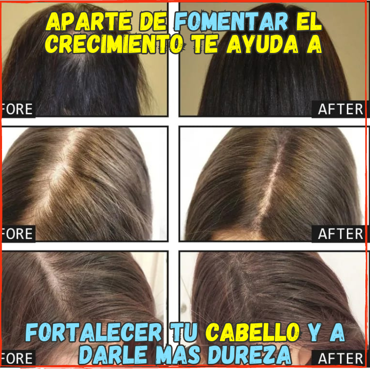 ✅Rejuvenece las Celulas de Crecimiento del Cabello😱, y Fortalece tu Cabello(💥Pagas al Recibirlo💥)