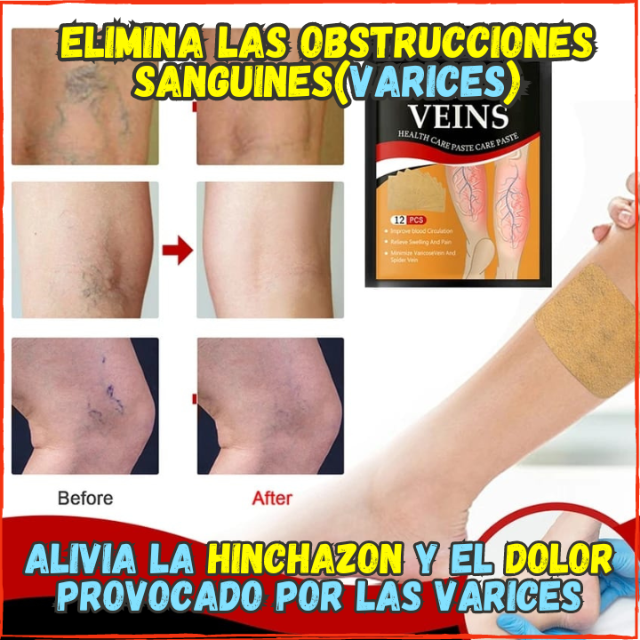 ✅Despidete de las Varices🙌, Pack de 72 Parches Para las Varices(💥Pagas al Recibirlo💥) Con Efecto Curativo