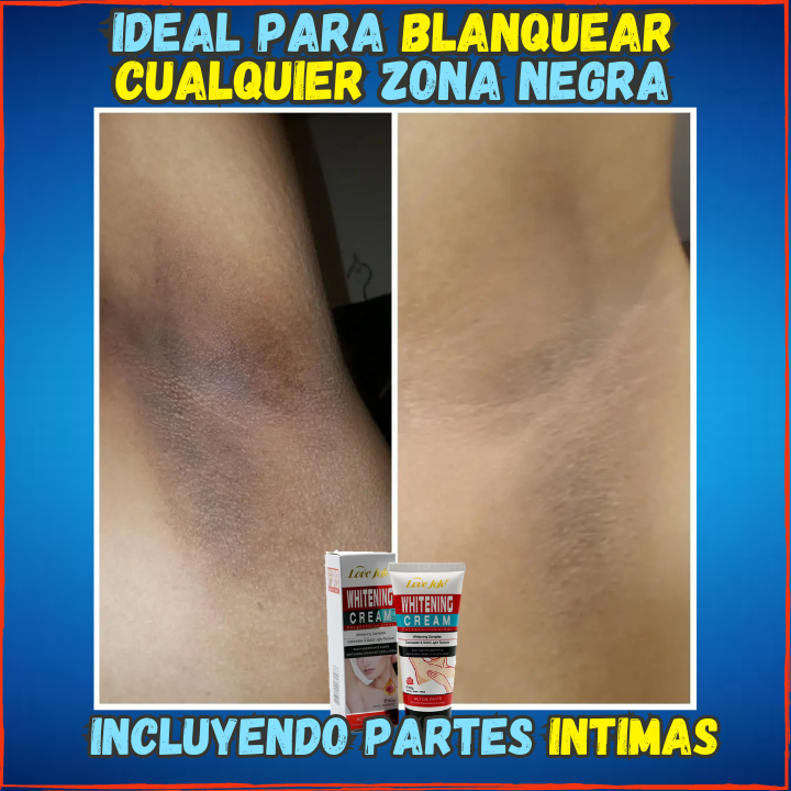 ✅Blanquea tu Piel en 3 Semanas😱, Crema Ultra Blanqueadora Con Colageno(💥Pagas al Recibirlo💥)