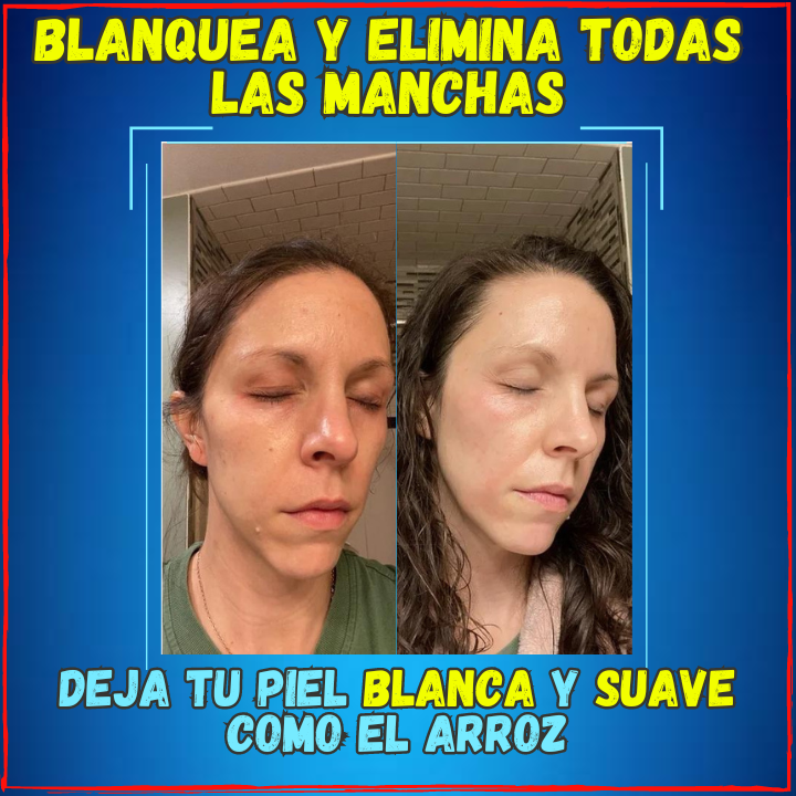 ✅Rejuvenece tu Rostro en Semanas😱, Tratamiento Facial 5 en 1 BioAqua(💥Pagas al Recibirlo💥) Descubre el Gran Secreto de la Belleza Facial.