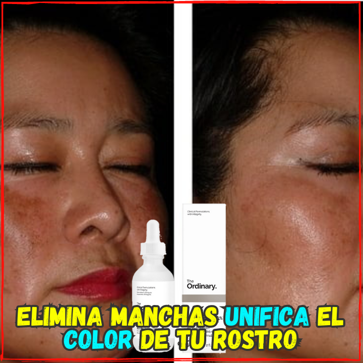 ✅Elimina el Agne, Espinillas y Porocidades En Poco tiempo😉, Ideal para tener un Rostro Limpio y Libre de Manchas(💥Pagas al Recibirlo💥)