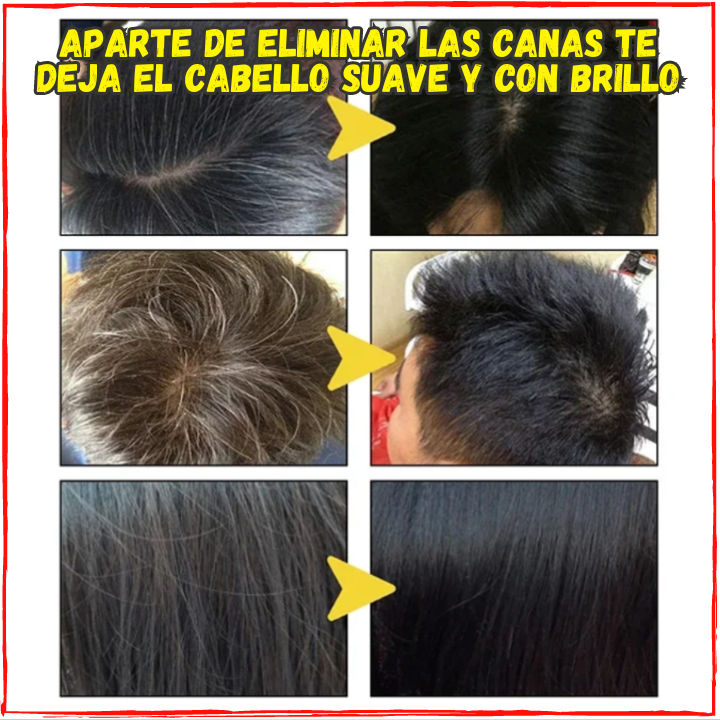 ✅La Forma Mas Segura y Natural de Eliminar las Canas😱,Sin Peroxido Ni Sustancias Dañinas(💥Pagas al Recibirlo💥)Se usa 1 Vez Cada 15 Dias.