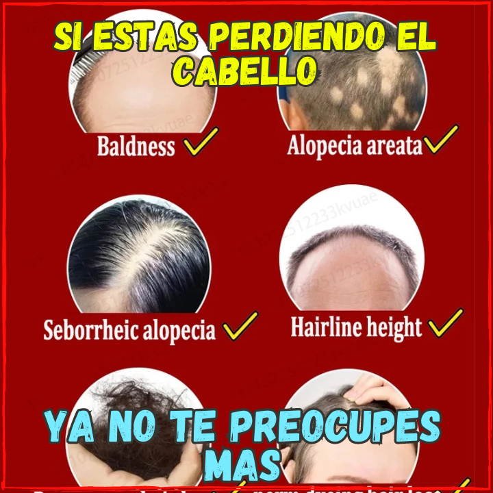 ✅Has que tu Pelo Vuelva a Crecer en 3 Meses😱, Locion Para Alopecia Para Hombre y Mujer(💥Pagas al Recibirlo💥)