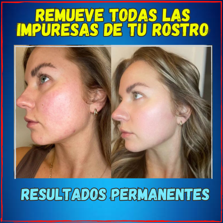 ✅Rejuvenece tu Rostro en Semanas😱, Tratamiento Facial 5 en 1 BioAqua(💥Pagas al Recibirlo💥) Descubre el Gran Secreto de la Belleza Facial.