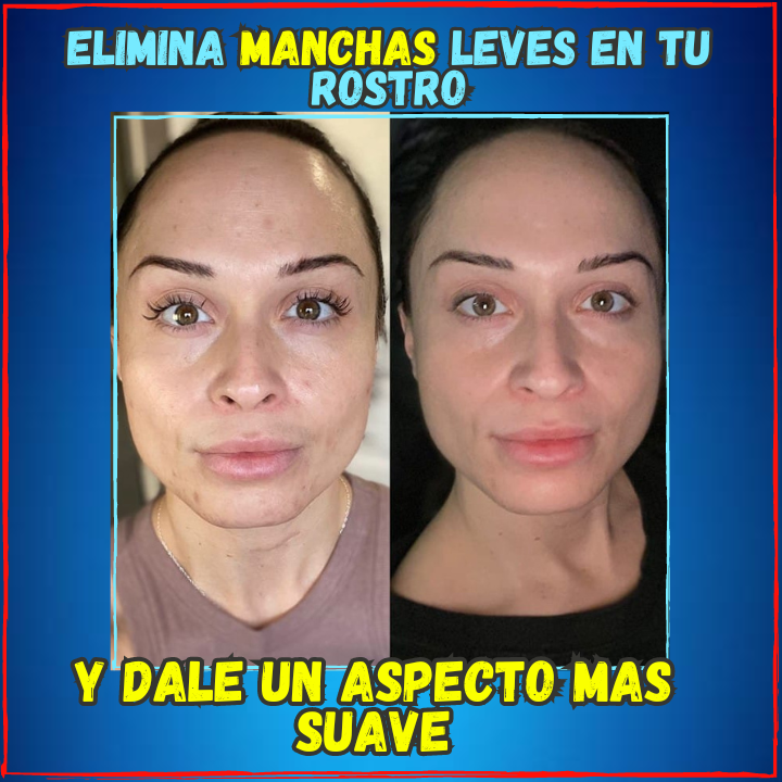 ✅Blanquea tu Piel en 3 Semanas😱, Crema Ultra Blanqueadora Con Colageno(💥Pagas al Recibirlo💥)