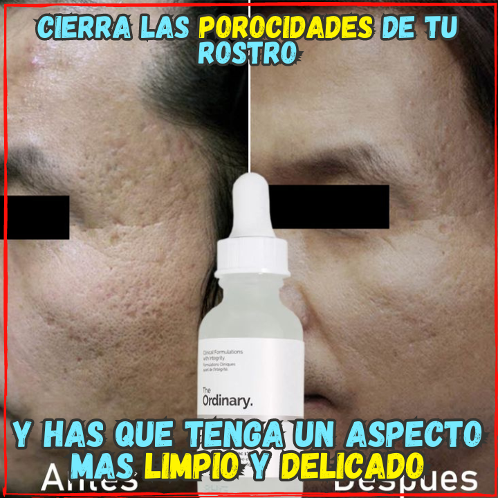 ✅Elimina el Agne, Espinillas y Porocidades En Poco tiempo😉, Ideal para tener un Rostro Limpio y Libre de Manchas(💥Pagas al Recibirlo💥)