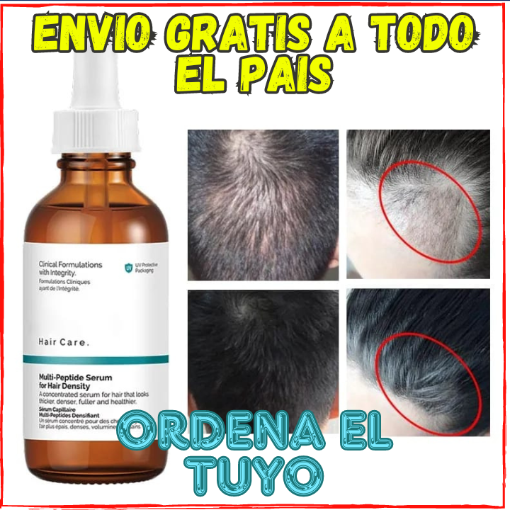 ✅Rejuvenece las Celulas de Crecimiento del Cabello😱, y Fortalece tu Cabello(💥Pagas al Recibirlo💥)